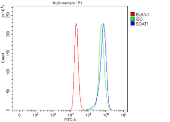 SOAT1 Rabbit Polyclonal Antibody