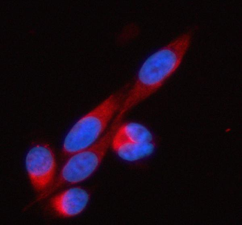 SOAT1 Rabbit Polyclonal Antibody