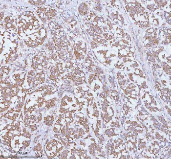 SOAT1 Rabbit Polyclonal Antibody