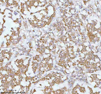 SOAT1 Rabbit Polyclonal Antibody