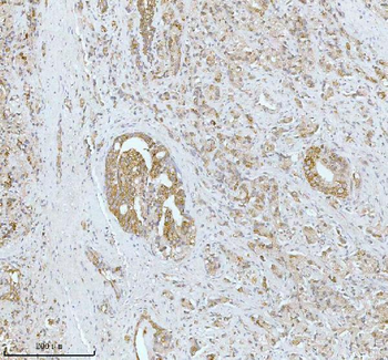 SOAT1 Rabbit Polyclonal Antibody