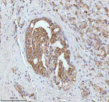 SOAT1 Rabbit Polyclonal Antibody