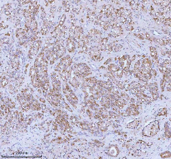 SOAT1 Rabbit Polyclonal Antibody