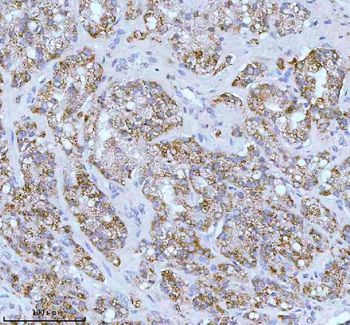 SOAT1 Rabbit Polyclonal Antibody