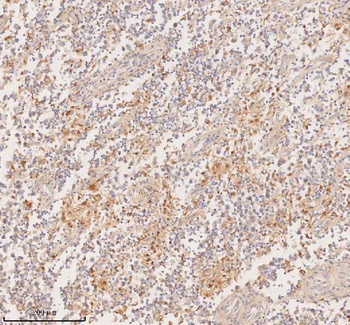 DDX58/RIG-1/RIG Rabbit Polyclonal Antibody