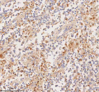 DDX58/RIG-1/RIG Rabbit Polyclonal Antibody