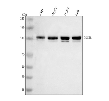 DDX58/RIG-1/RIG Rabbit Polyclonal Antibody