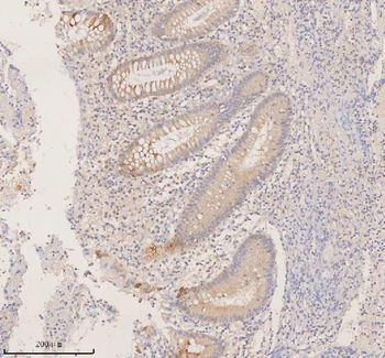 DDX58/RIG-1/RIG Rabbit Polyclonal Antibody