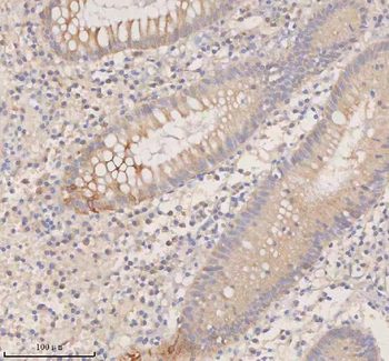 DDX58/RIG-1/RIG Rabbit Polyclonal Antibody