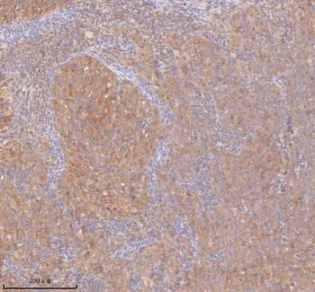 DDX58/RIG-1/RIG Rabbit Polyclonal Antibody
