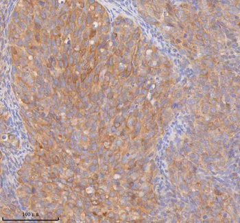DDX58/RIG-1/RIG Rabbit Polyclonal Antibody