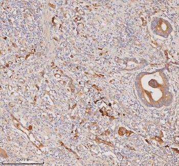 DDX58/RIG-1/RIG Rabbit Polyclonal Antibody