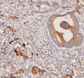 DDX58/RIG-1/RIG Rabbit Polyclonal Antibody
