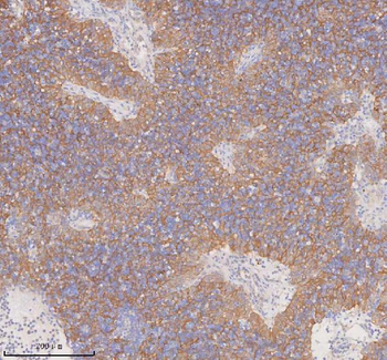 DDX58/RIG-1/RIG Rabbit Polyclonal Antibody