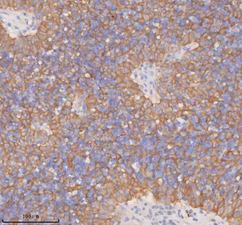 DDX58/RIG-1/RIG Rabbit Polyclonal Antibody