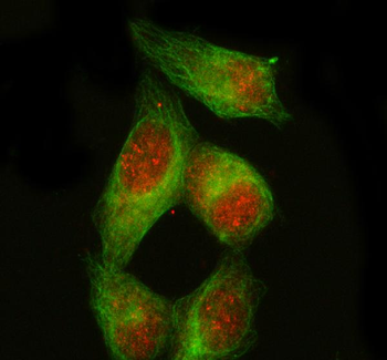 PDX1 Rabbit Polyclonal Antibody