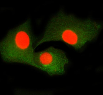 SMTN Rabbit Polyclonal Antibody