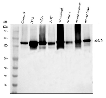 SMTN Rabbit Polyclonal Antibody