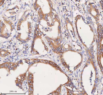 SCAMP3 Rabbit Polyclonal Antibody