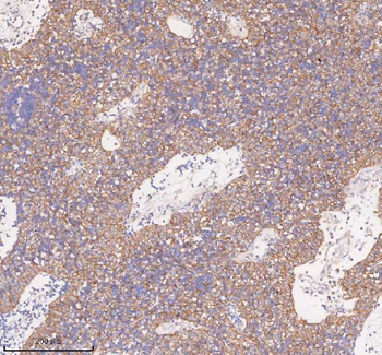 SCAMP3 Rabbit Polyclonal Antibody