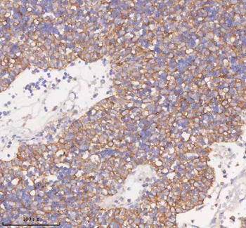 SCAMP3 Rabbit Polyclonal Antibody