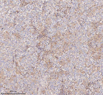 SCAMP3 Rabbit Polyclonal Antibody