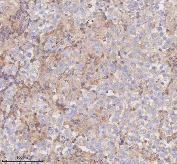 SCAMP3 Rabbit Polyclonal Antibody