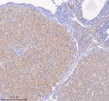 SCAMP3 Rabbit Polyclonal Antibody