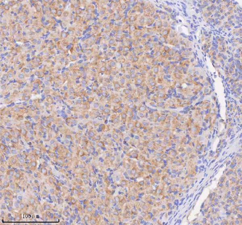 SCAMP3 Rabbit Polyclonal Antibody