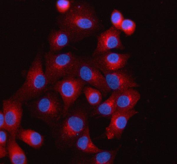 SCAMP3 Rabbit Polyclonal Antibody