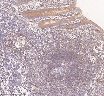 SCAMP3 Rabbit Polyclonal Antibody
