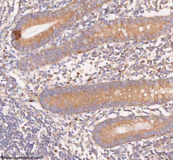 SCAMP3 Rabbit Polyclonal Antibody