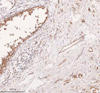 SCAMP3 Rabbit Polyclonal Antibody