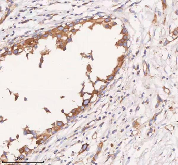 SCAMP3 Rabbit Polyclonal Antibody