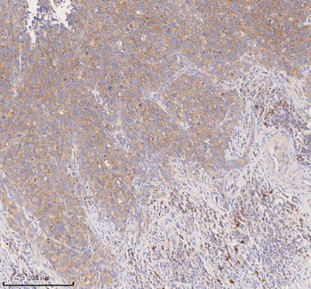 SCAMP3 Rabbit Polyclonal Antibody