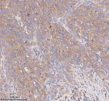 SCAMP3 Rabbit Polyclonal Antibody