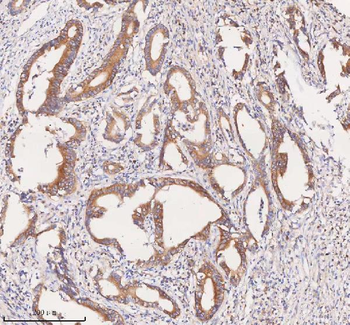 SCAMP3 Rabbit Polyclonal Antibody