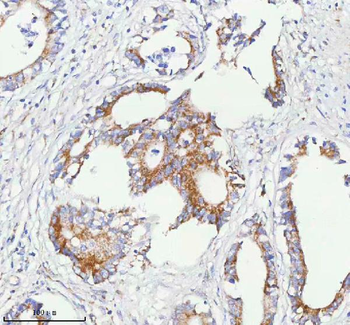 SASS6 Rabbit Polyclonal Antibody