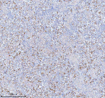 SASS6 Rabbit Polyclonal Antibody