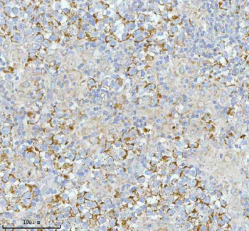 SASS6 Rabbit Polyclonal Antibody