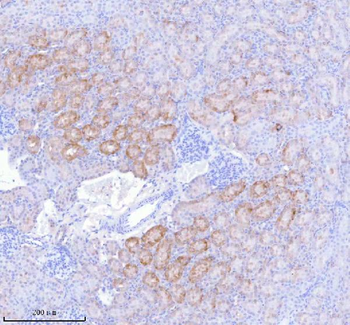 SASS6 Rabbit Polyclonal Antibody
