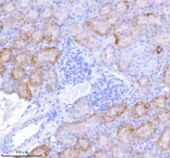 SASS6 Rabbit Polyclonal Antibody