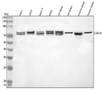 SASS6 Rabbit Polyclonal Antibody