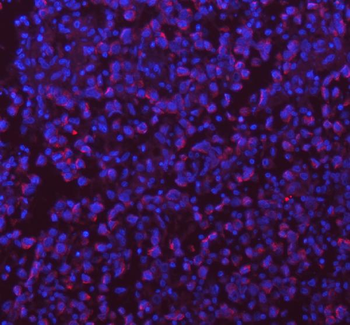 SASS6 Rabbit Polyclonal Antibody
