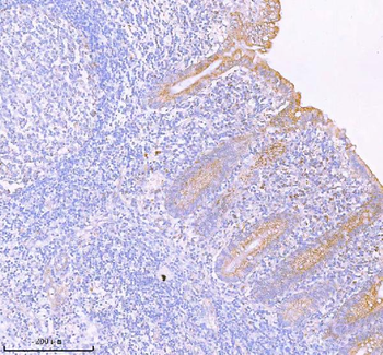 SASS6 Rabbit Polyclonal Antibody