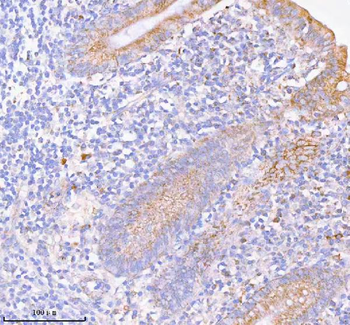 SASS6 Rabbit Polyclonal Antibody