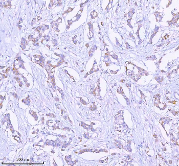 SASS6 Rabbit Polyclonal Antibody