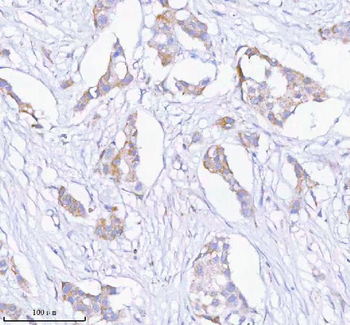 SASS6 Rabbit Polyclonal Antibody