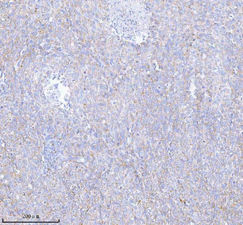 SASS6 Rabbit Polyclonal Antibody