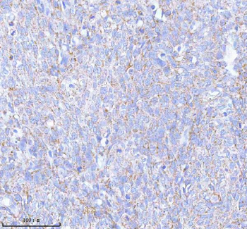 SASS6 Rabbit Polyclonal Antibody